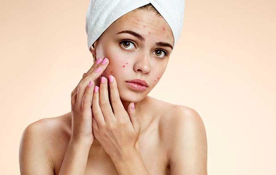 Acne Scar Removal